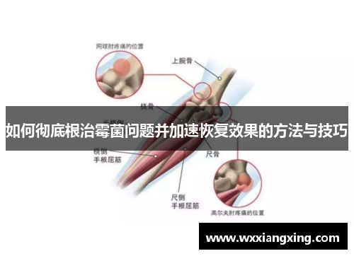 如何彻底根治霉菌问题并加速恢复效果的方法与技巧